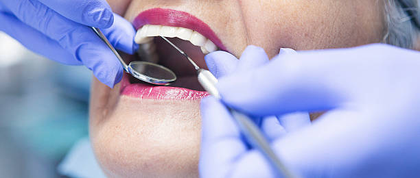 Best Pediatric Emergency Dentist in Boulder Hl, IL